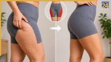 Thighs and Hips Fat