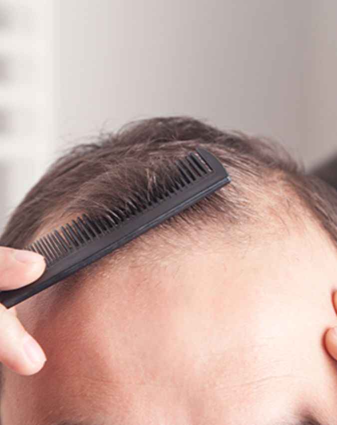 स्कैल्प के लिए खतरनाक