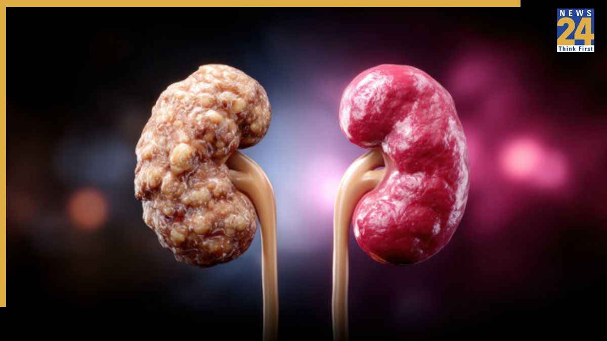 किडनी के मरीज को उल्टी क्यों आती है? ये 5 संकेत बिल्कुल ना करें नजरअंदाज