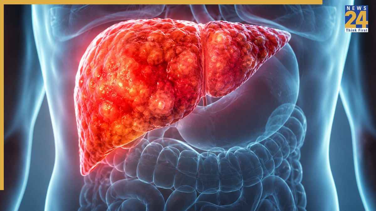 लिवर की सूजन कम करने के लिए क्या खाएं? ये 6 सुपरफूड कर सकते हैं मदद