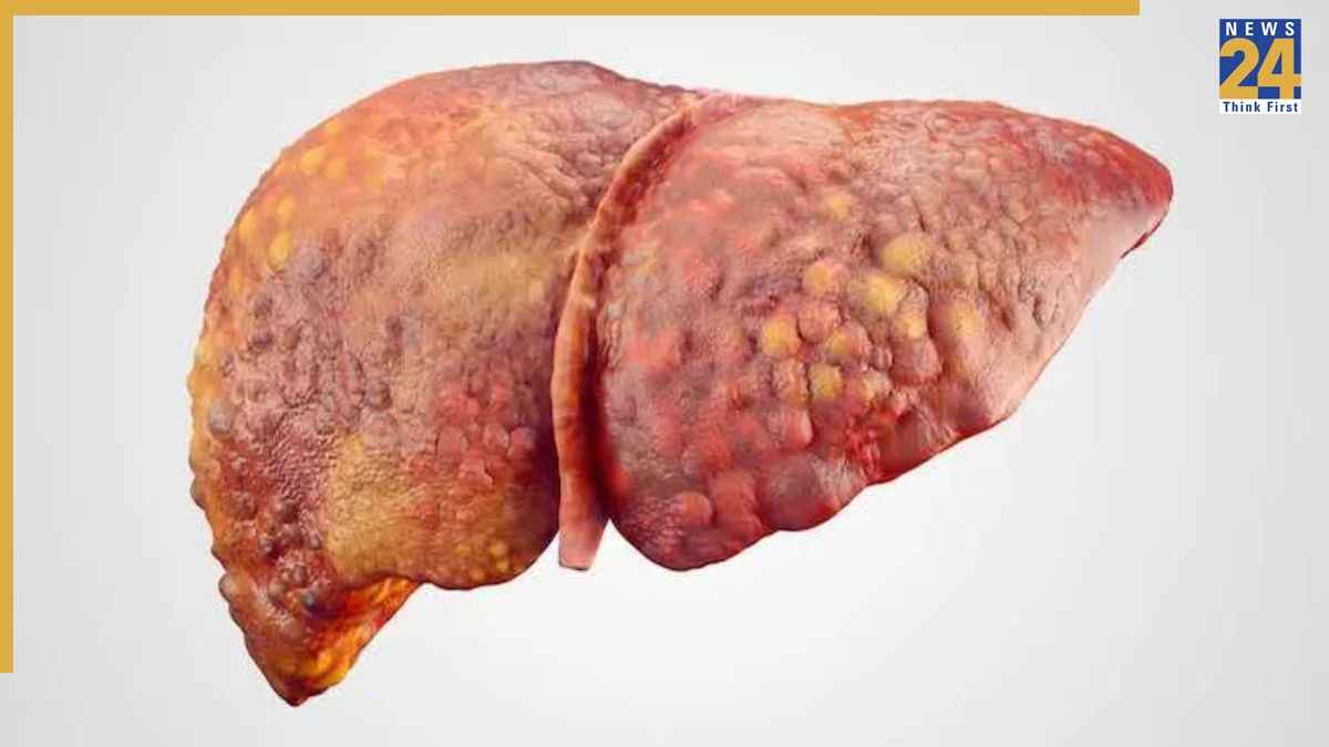 Fatty Liver: लिवर में दर्द क्यों होता है? शुरुआती लक्षण नहीं करने चाहिए नजरअंदाज