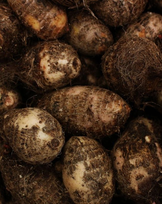 Diabetes diet Vegetables to avoid-1-2-3-4