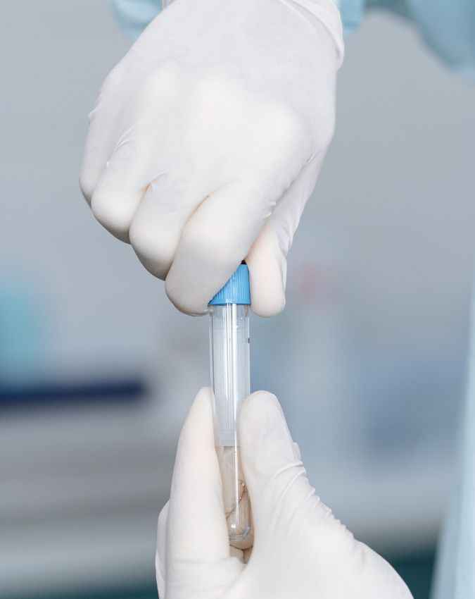 क्रिएटनिन ब्लड टेस्ट और eGFR 