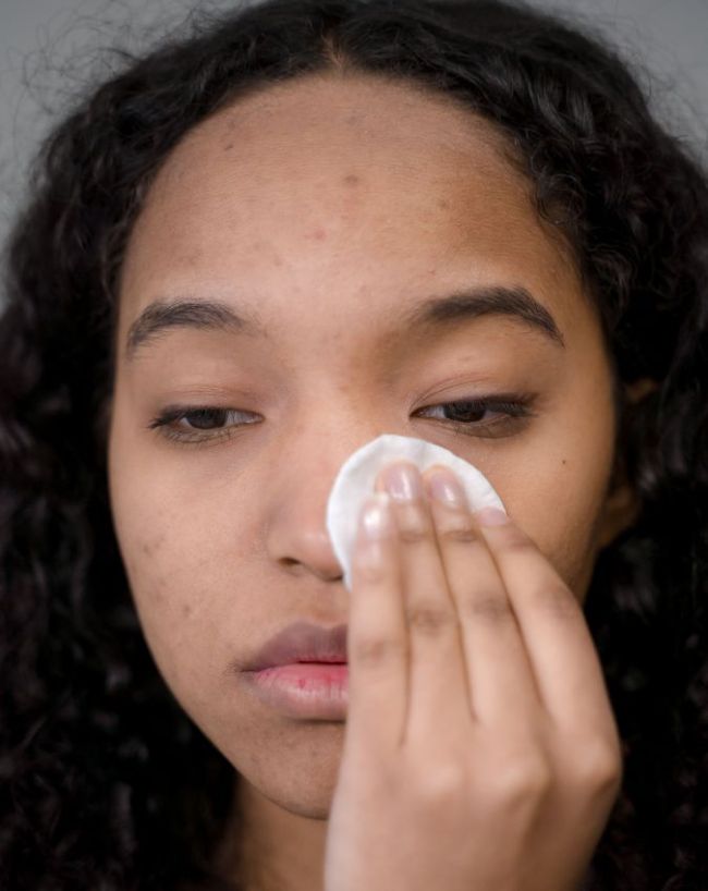 How To Remove Blackheads-1-2