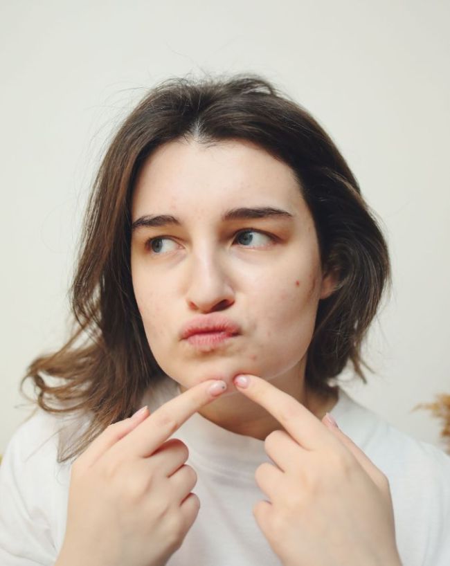 How To Remove Blackheads-1-2-3-4-5-6-7