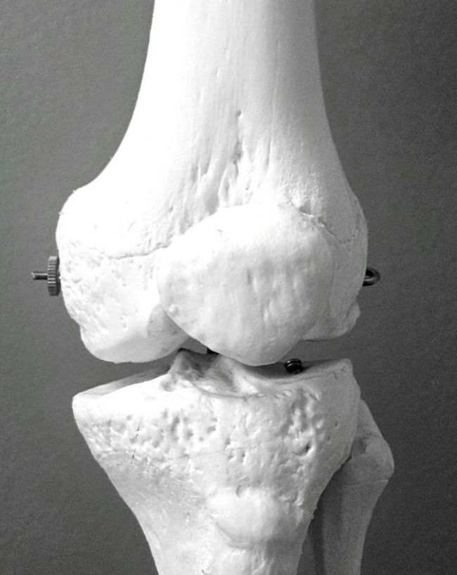 Knee pain exercise-1-2-3-4-5