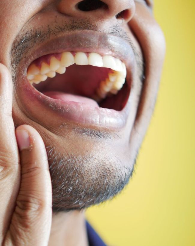 how to clean yellow teeth-1-2-3-4