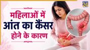 Women Colon Cancer