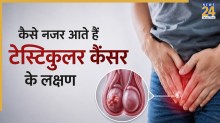 Testicular Cancer Symptoms