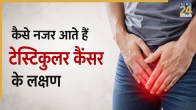 Testicular Cancer Symptoms