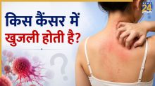 khujli In Cancer