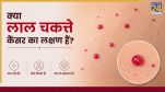 Red Spots Cancer Symptoms