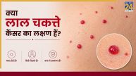 Red Spots Cancer Symptoms