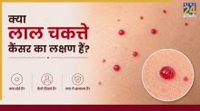 Red Spots Cancer Symptoms
