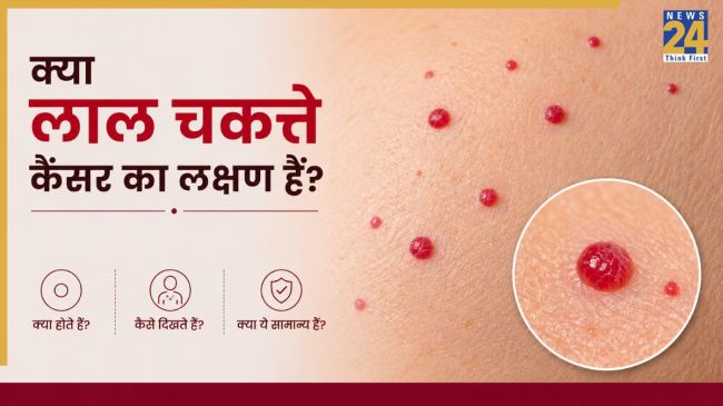 Red Spots Cancer Symptoms