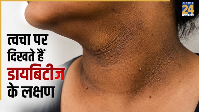 Early Signs Of Diabetes