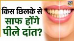 how to clean yellow teeth