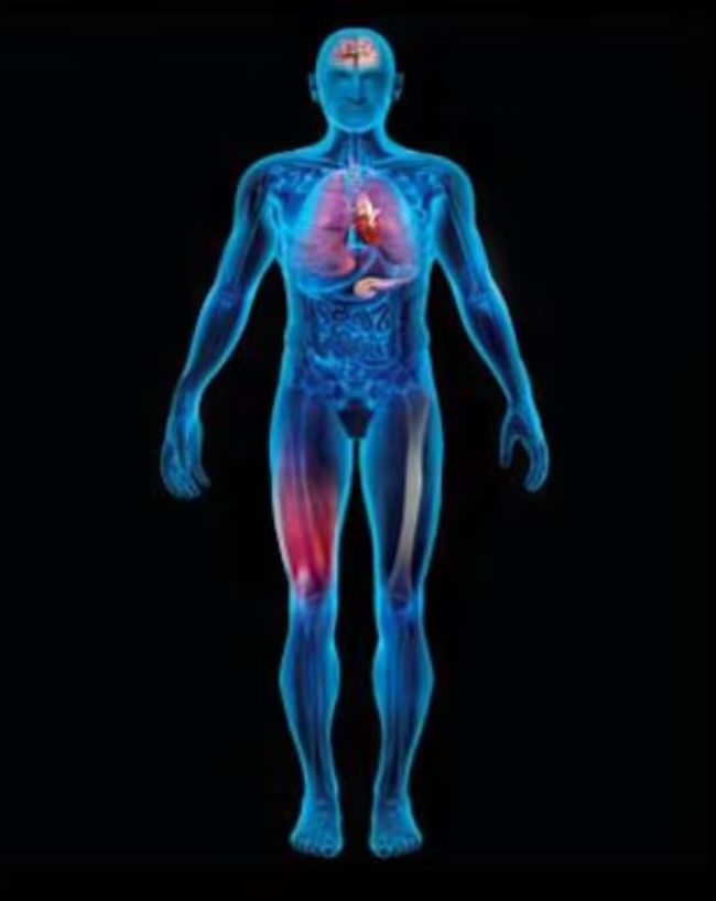 vitamin D deficiency significantly-1-2-3-4-5-6-7