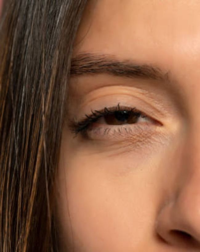 Open Eye Sleeping Disorder-1-2-3-4