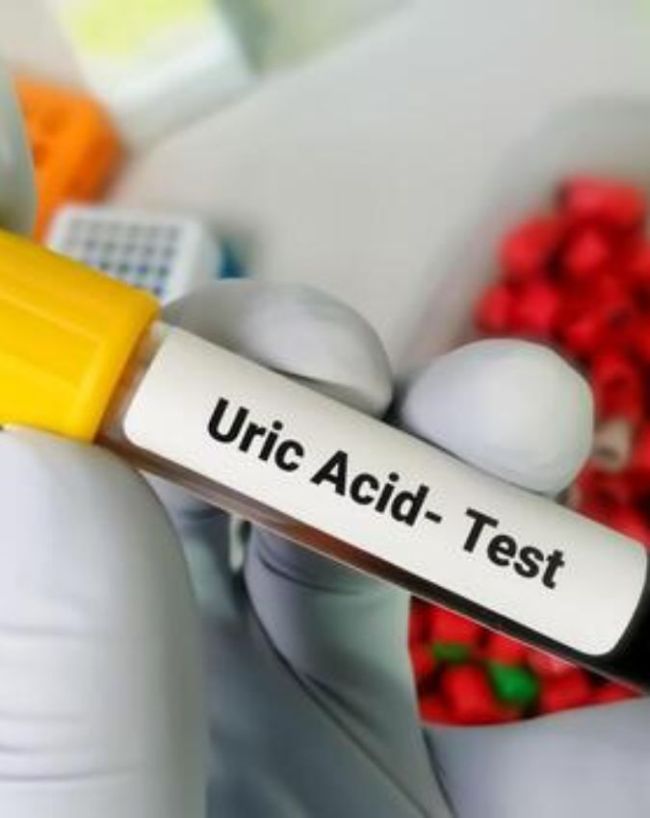 uric acid food to avoid-1-2