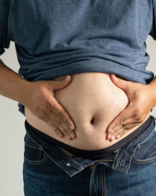 Belly Fat Causes-1-2-3