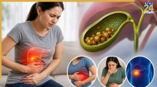 Gallbladder Stone Symptoms