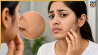 Face Hair Problem