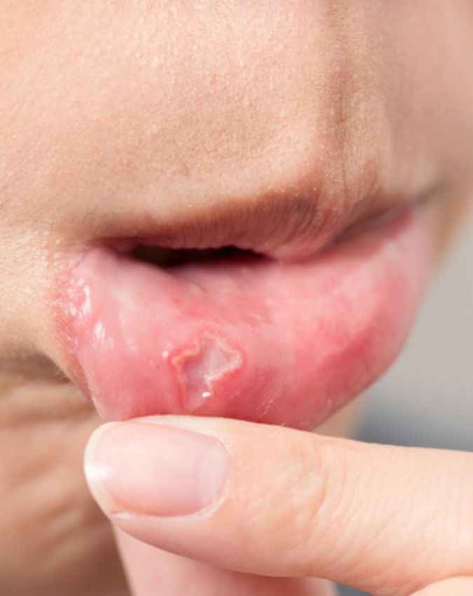 मसूड़ों की सूजन कम करने में मददगार होना  