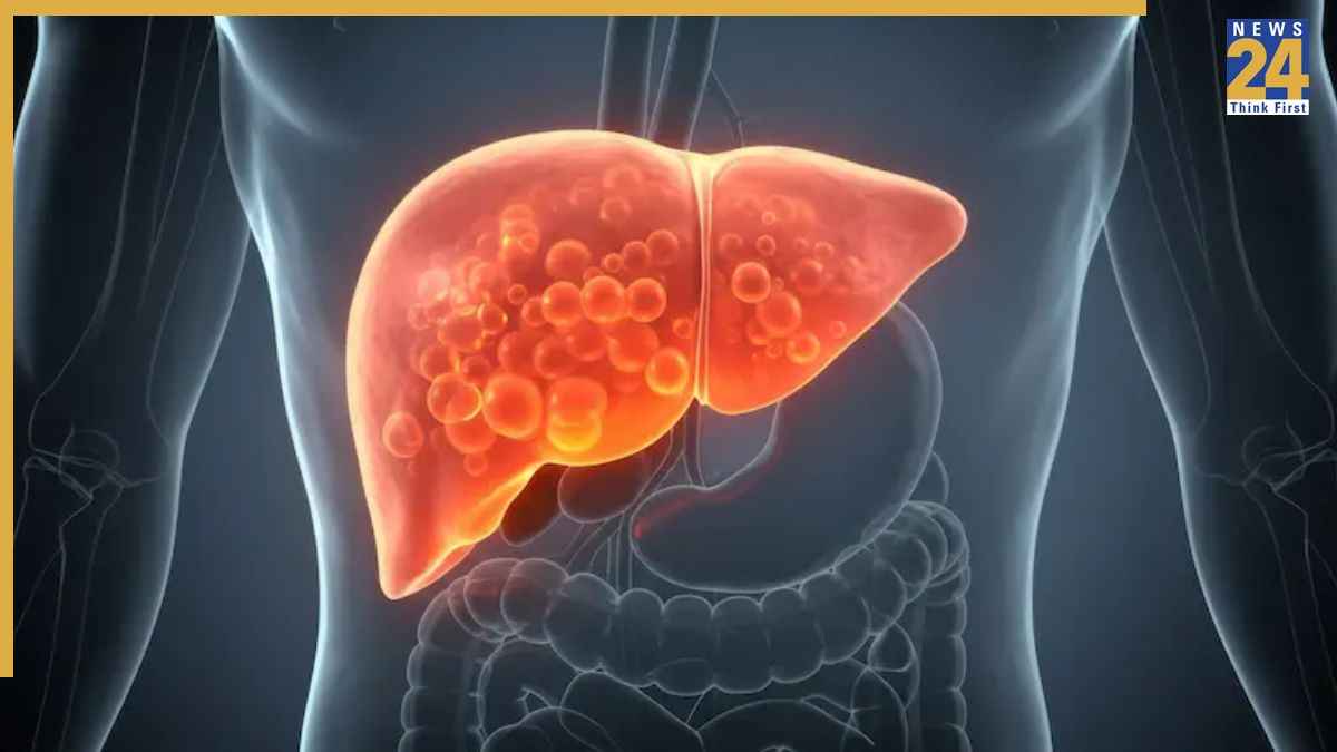 Fatty Liver में फायदेमंद हैं ये हेल्दी स्नैक्स, AIIMS के डॉक्टर ने बताया क्या खाएं
