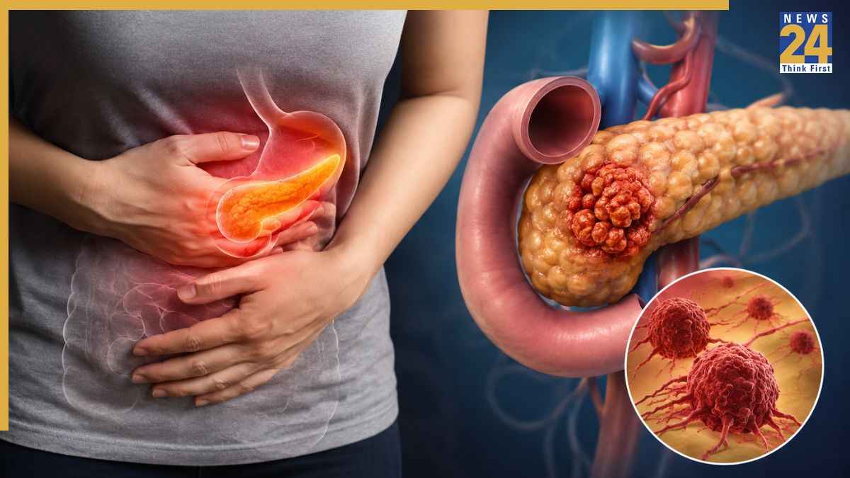 Pancreatic Cancer