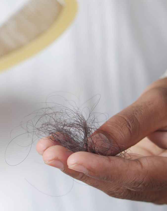 बाल झड़ना 