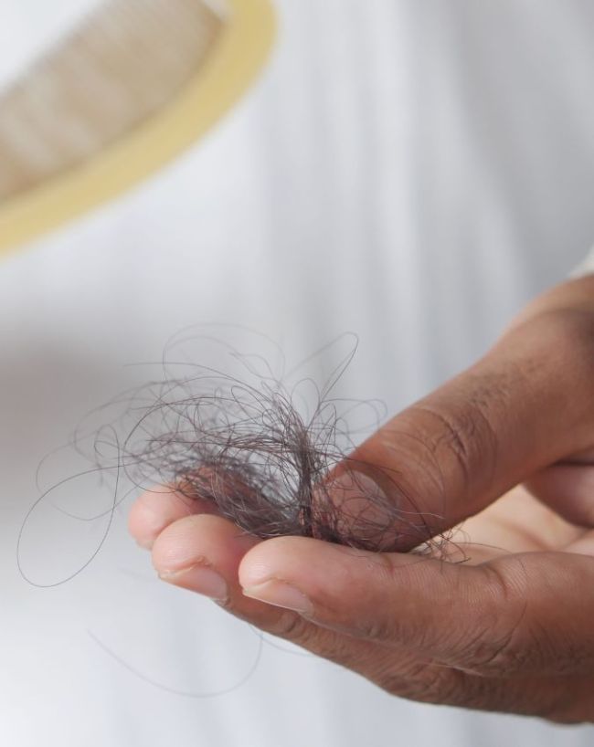 Vitamin D Deficiency Signs On Hair-1-2-3-4