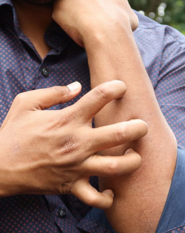whom mosquitoes bite more-1-2-3