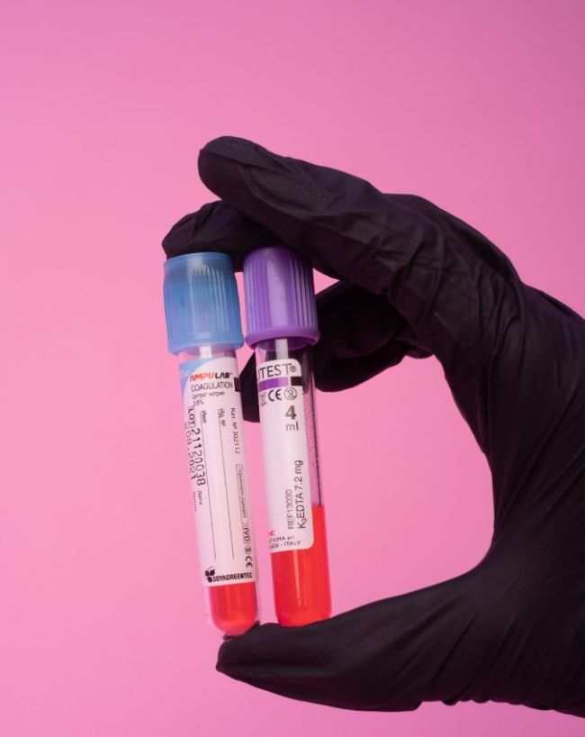 test for male infertility-1-2-3-4