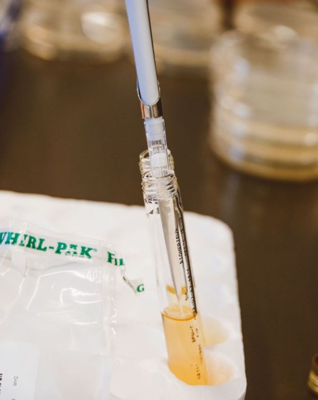 test for male infertility-1-2-3-4-5-6