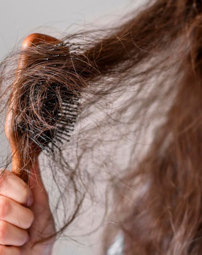 Vitamin D Deficiency Signs On Hair-1-2-3