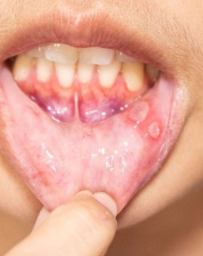 7 Warning Signs Of Cancer-1-2-3-4-5-6-7-8