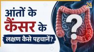 Colon Cancer Ke Lakshan