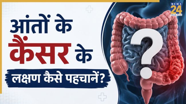 Colon Cancer Ke Lakshan