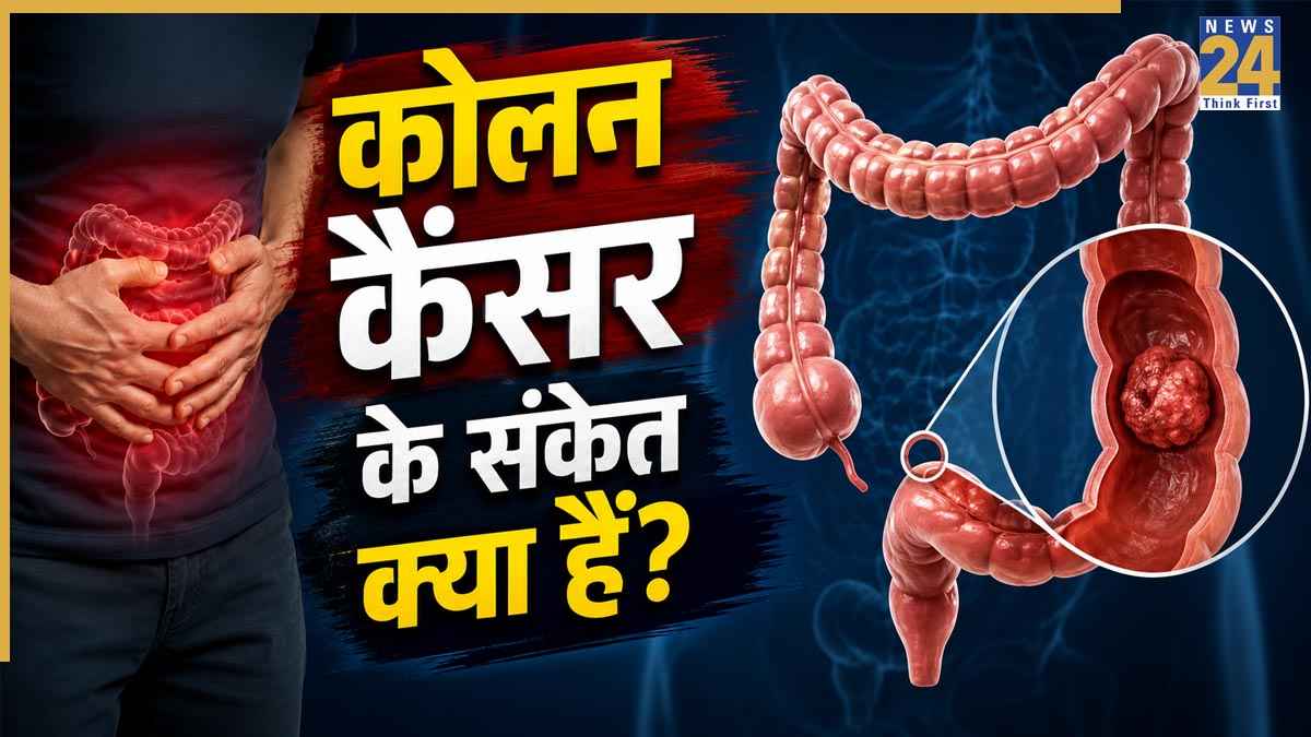 Colon Cancer: कोलन कैंसर के 6 छिपे हुए संकेत, जिन्हें नजरअंदाज नहीं करना चाहिए