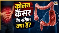 Colon Cancer Symptoms