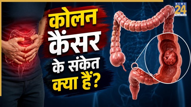 Colon Cancer Symptoms