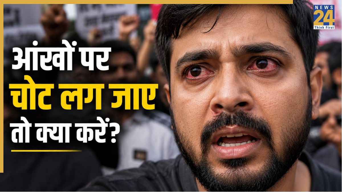 आंख पर डंडा या हाथ लग जाए तो तुरंत करें यह काम, डॉक्टर ने बताया आंखों की रोशनी बचाने का तरीका