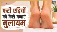 Cracked Heels Home Remedies