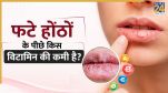 kis vitamin ki kami se honth fatate hain