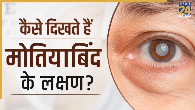 Motiyabind Symptoms