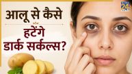 potato juice for dark circles