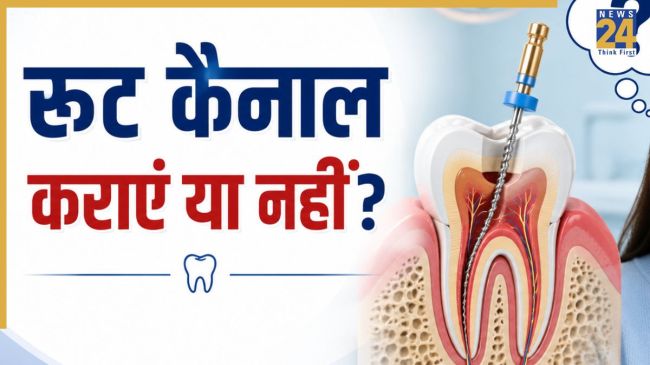 Root Canal Treatment