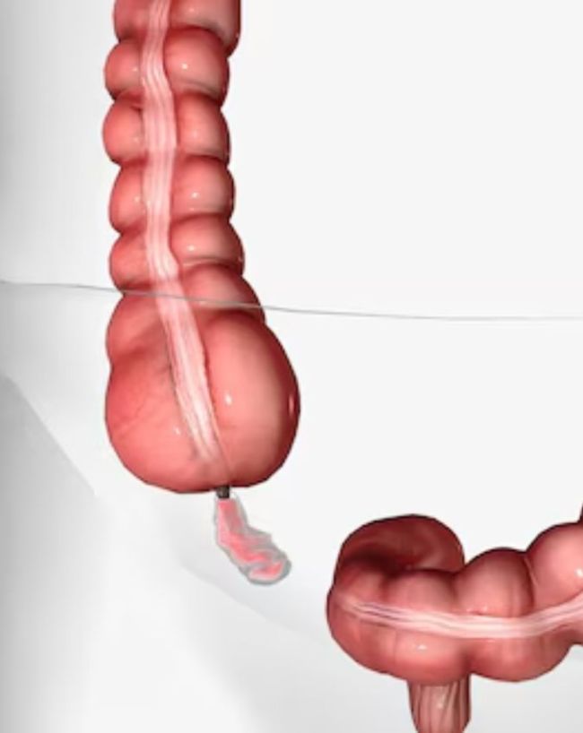 Poop After Eating Reasons-1-2-3-4-5-6-7-8