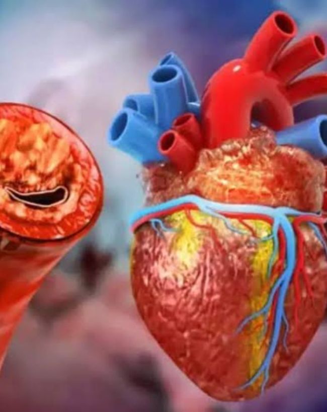 Warning Signs of Heart Blockage-1-2